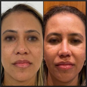 nariz feminino 1