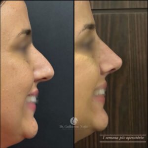 nariz feminino 2