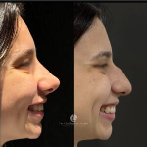 nariz feminino 3