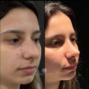 nariz feminino 4