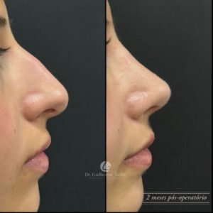nariz feminino 5