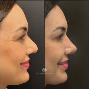 nariz feminino 6