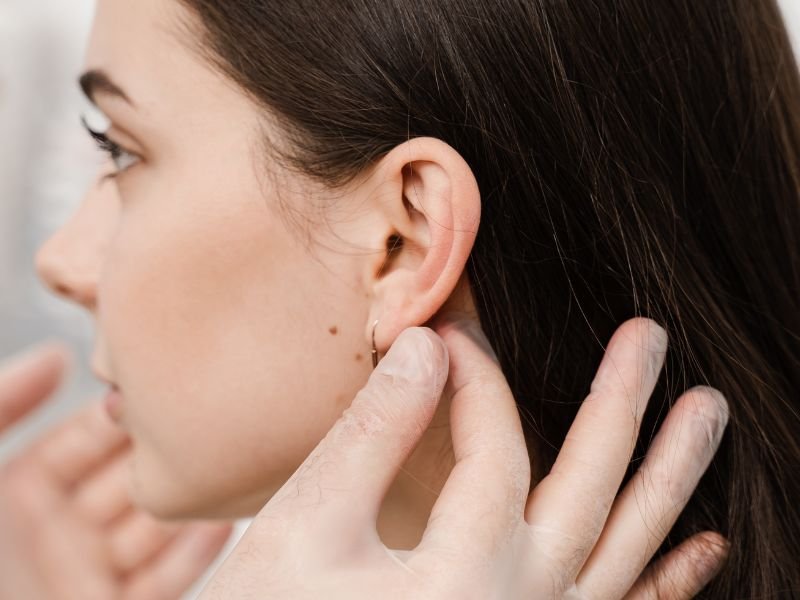 Otoplastia em Curitiba